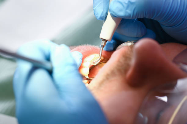 Best Emergency Denture Repair in Menlo Park Terrace, NJ
